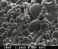 [写真]発色剤が包まれたマイクロカプセルの顕微鏡写真